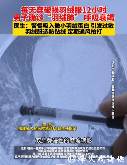 破羽绒服连穿四周,福州一男子确诊“羽绒肺”!医生提醒:严重或致呼吸衰竭! 破羽绒服连穿四周,福州一男子确诊“羽绒肺”!医生提醒:严重或致呼吸衰竭!